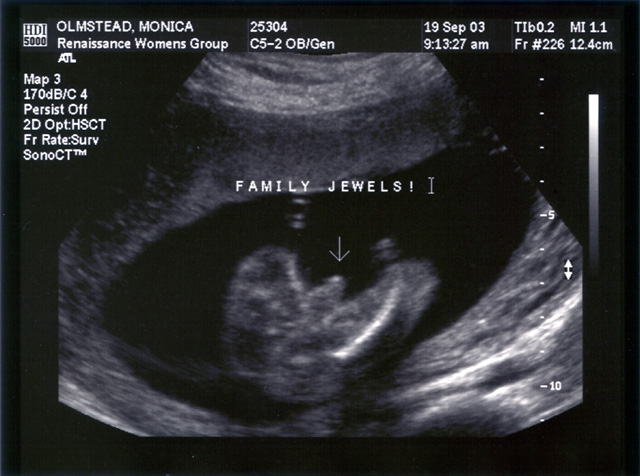 Baby Mojo